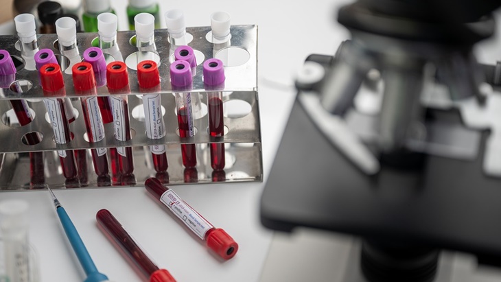 Ketahui Syarat Penting untuk Jadi Pendonor Plasma Konvalesen