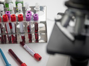 Ketahui Syarat Penting untuk Jadi Pendonor Plasma Konvalesen