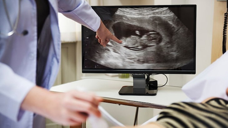 AI Deteksi Cacat Lahir Langka pada Ultrasound Janin