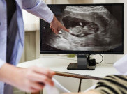 AI Deteksi Cacat Lahir Langka pada Ultrasound Janin