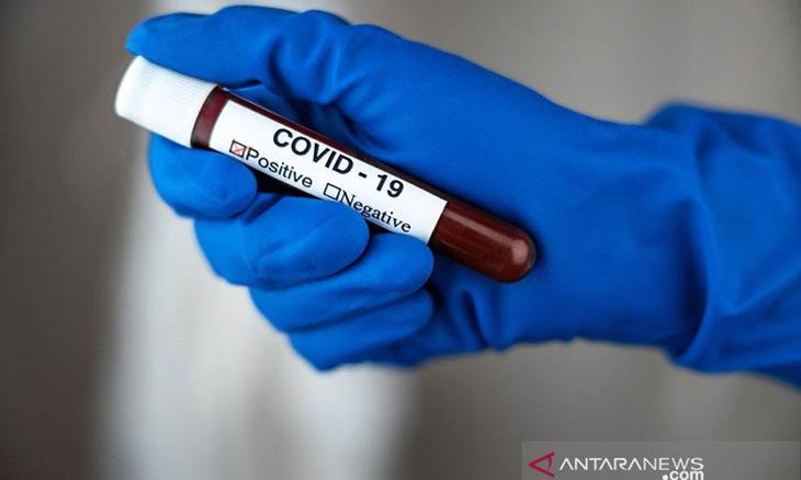 Tangan seorang perawat dalam sarung tangan memegang tabung reaksi dengan tulisan COVID 19 dengan tes darah positif. (ANTARA/Shutterstock/pri).