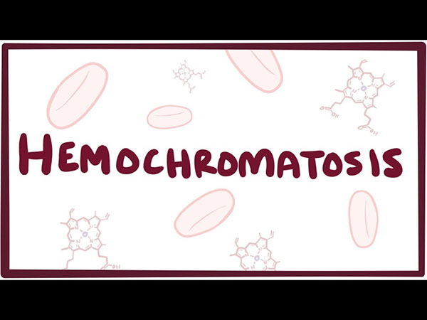 Hemochromatosis (Foto: Boldsky)