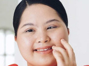Penyandang Down Syndrome Jadi Model Skincare Lokal
