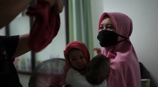 Anak kembar siam di Bandung, Jawa Barat. (Foto: Antara)