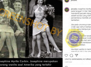 [HOAKS atau FAKTA]: Foto Josephine Myrtle Corbin, Wanita yang Miliki Empat Kaki