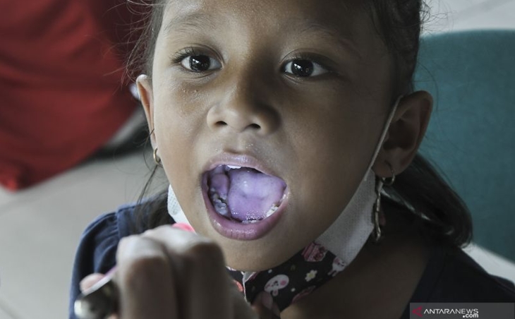 Mulai Besok Anak Usia 6-11 Tahun Disuntik COVID-19, Ada 115 Daerah Cakupan