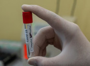 Ini nih Arti CT Value dalam Tes PCR