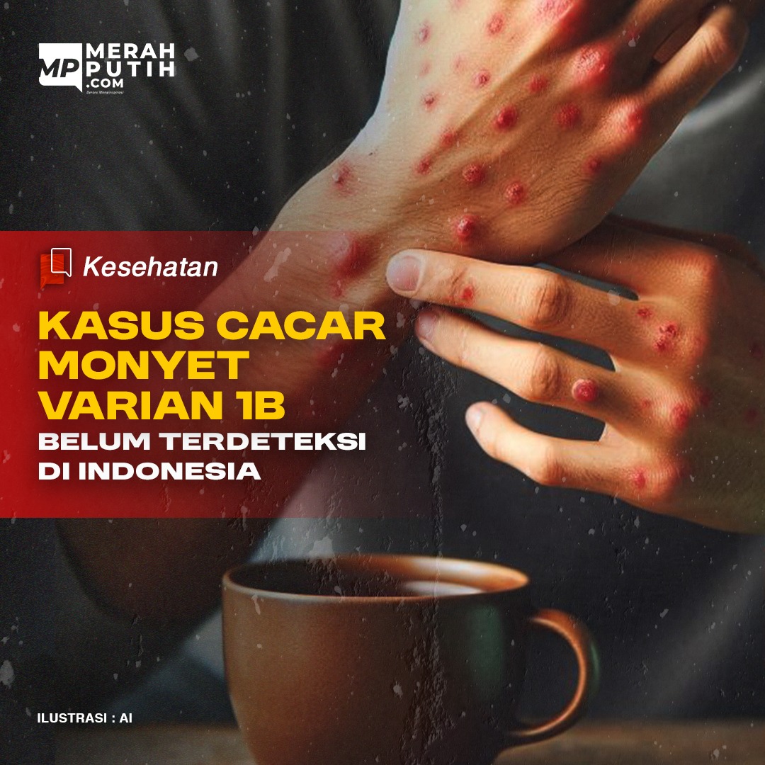 Kasus Cacar Monyet Varian 1B Belum Terdeteksi di Indonesia