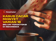 Kasus Cacar Monyet Varian 1B Belum Terdeteksi di Indonesia