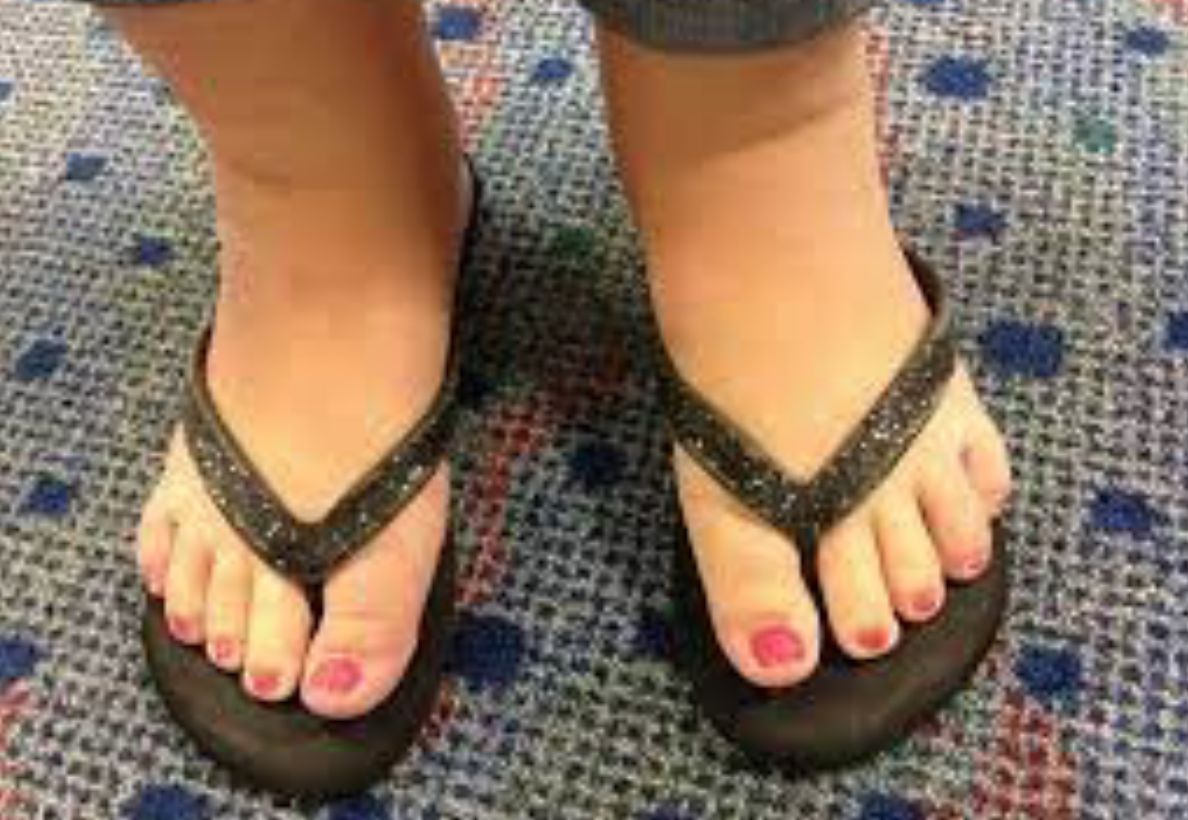 kaki bengkak
