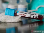 Update Corona DKI Kamis (9/7): 13.362 Positif, 8.645 Orang Sembuh