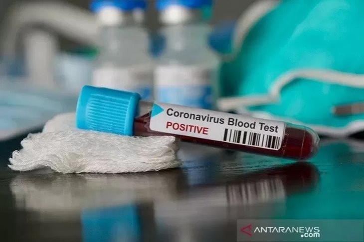 Ilustrasi - Sampel darah yang terindikasi positif virus corona. (ANTARA/Shutterstock/am.)
