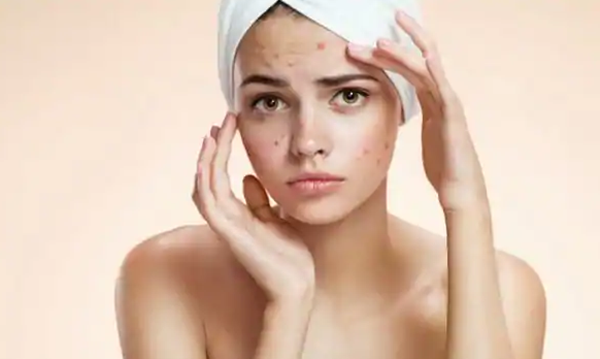 Retinol