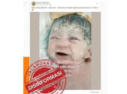 [HOAKS atau FAKTA]: Ibu Hamil Minum Air Kelapa Hilangkan Bercak Putih pada Bayi