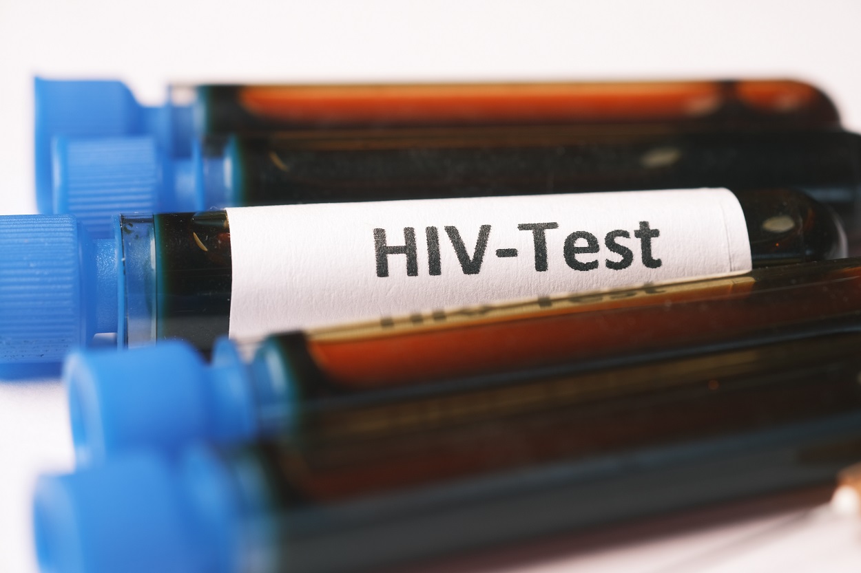 12.533 Anak Usia di Bawah 14 Tahun Terinfeksi HIV