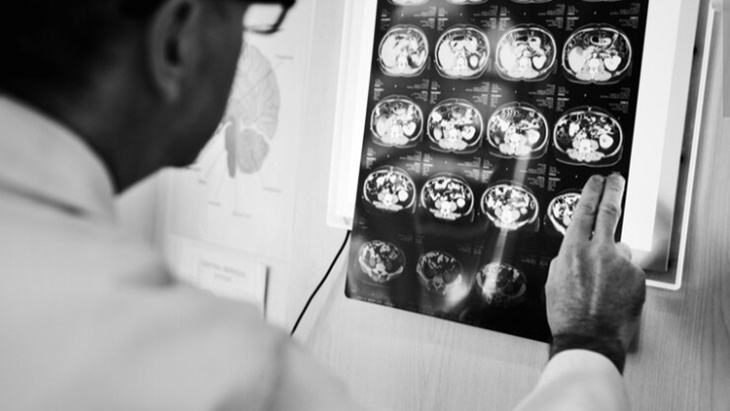 Membantu Pasien Kanker Berhubungan dengan Diagnosis dan Perawatan