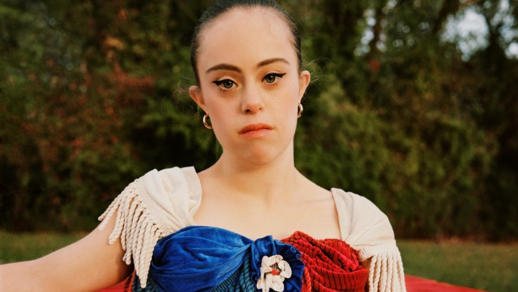 Model Down Syndrome Buka Perspektif Baru di Dunia Fesyen