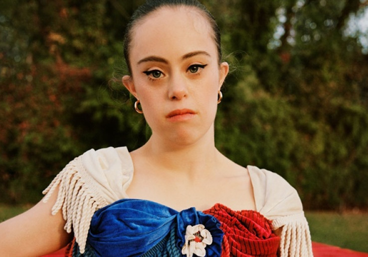 Model Down Syndrome Buka Perspektif Baru di Dunia Fesyen
