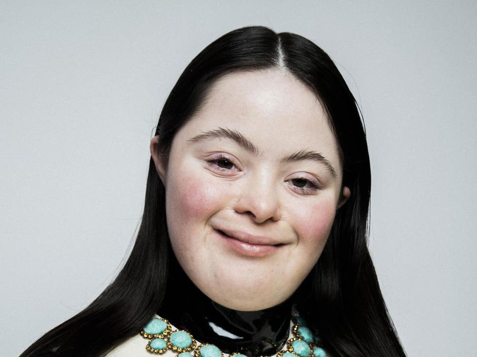 Gucci Beauty Gandeng Model Down Syndrom untuk Kampanye Kecantikan