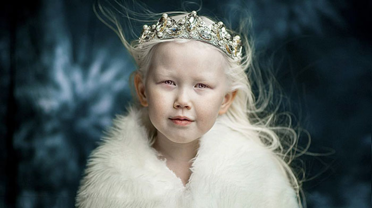Nariyana, Snow White 8 Tahun Asal Siberia