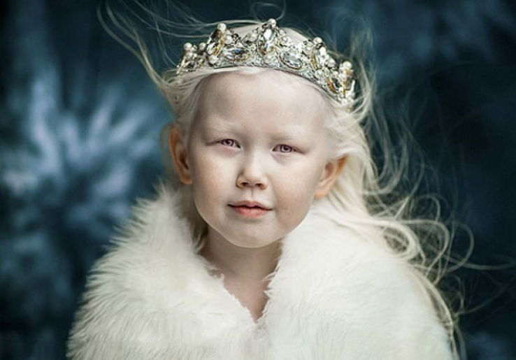 Nariyana, Snow White 8 Tahun Asal Siberia