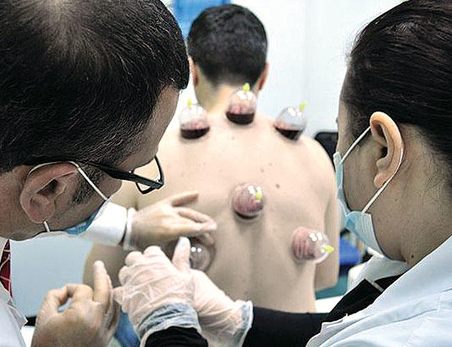 Ada dua cara metode bekam (Sumber: hurriyetdailynews.com)