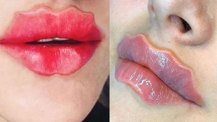 Tren 'Devil Lips', Cantik Atau Mengerikan?