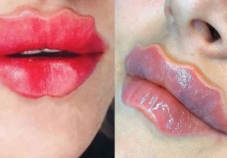 Tren 'Devil Lips', Cantik Atau Mengerikan?