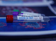 Positif COVID-19 Bertambah 4.170 Kasus
