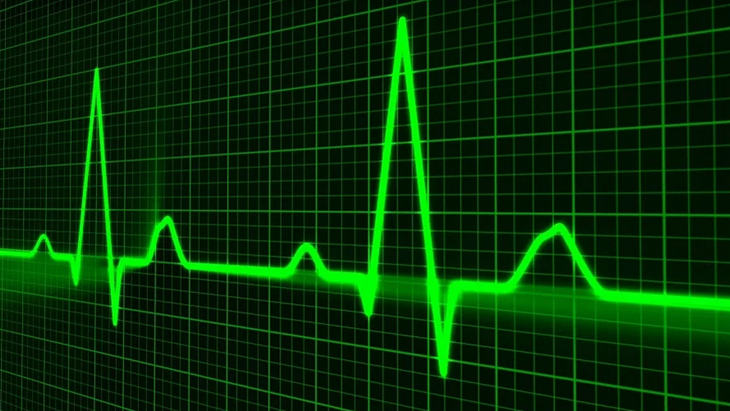 Mengenal Leadless Pacemaker, Alat Pacu Jantung Tanpa Operasi