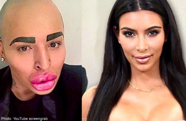 Pingin Mirip Kim Kardasian Bibir Pria Filipina Malah Jontor