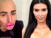 Pingin Mirip Kim Kardasian Bibir Pria Filipina Malah Jontor