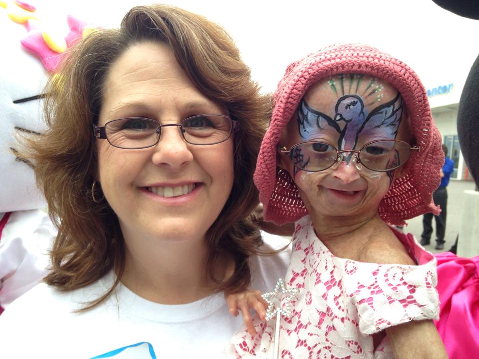 Bocah Delapan Tahun Tampak Seperti Nenek 70 Tahun