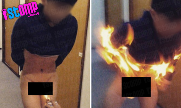 Foto Telanjang Seorang Pemuda Dengan Alat Vital Terbakar Beredar di Media Sosial