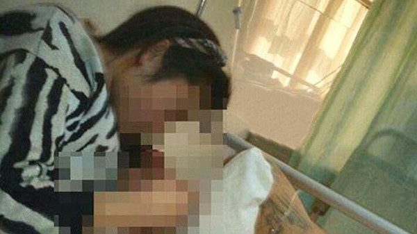 Ketahuan Selingkuh, Alat Vital Suami Dipotong Istri 2 Kali