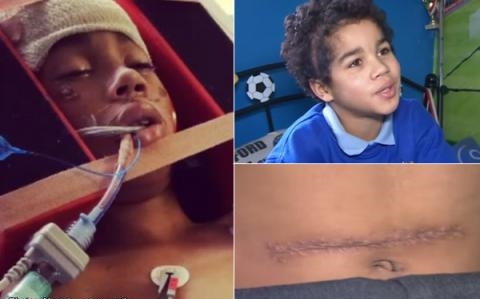 Usai Kecelakaan, Anak 9 Tahun ini Hidup dengan Tengkorak Tak Utuh