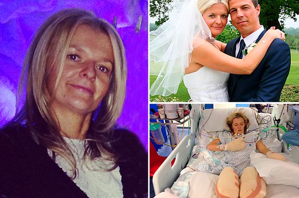 Ibu Super Sehat Koma dan Harus Diamputasi