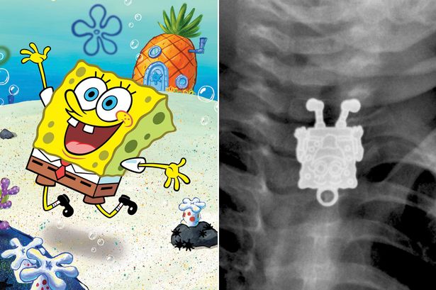 Ada SpongeBob di Tubuh Seorang Balita