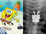Ada SpongeBob di Tubuh Seorang Balita