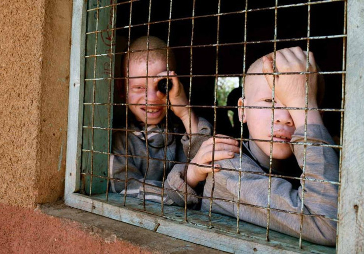 Manusia Albino Diburu Seperti Binatang di Tanzania