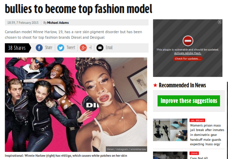 Penyakit Kulit Langka, Wanita Kanada Dipanggil Model Zebra