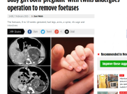 Satu Lagi Bayi Mengandung di Hongkong