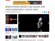 Polisi Selidiki Luka di Tubuh Bobbi Kristina
