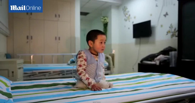 Video Haru Balita Menari Setelah Diamputasi