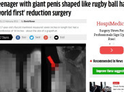 Operasi Pengecilan Penis Pertama di Dunia