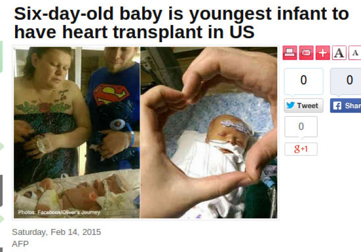 Bayi Pertama yang Melakukan Transplantasi Jantung