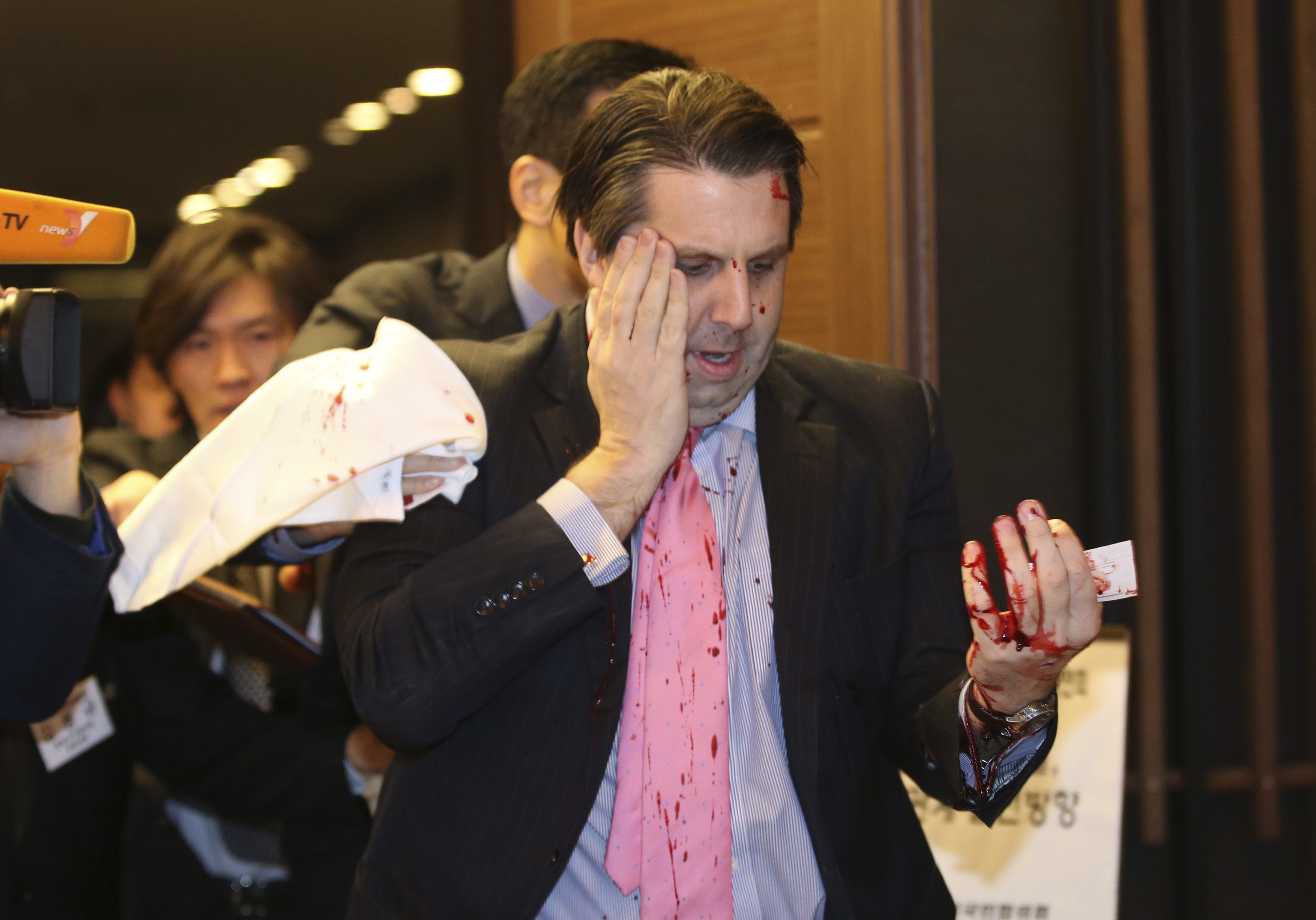 Dubes AS, Mark Lippert Diserang Warga Seoul di Korea