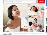 Senyum Mengharukan Gadis Kecil yang Diamputasi