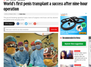 Transplantasi Penis Pertama di Dunia Sukses