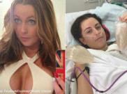 Bakteri Menyusup ke Payudara, Perempuan Ini Nyaris Tewas